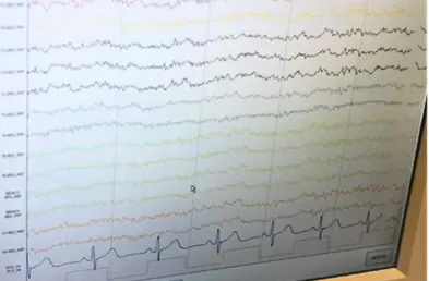 Figura 25. Visualizzazione in tempo reale dei segnali EEG ed ECG  sul display del computer Neurowave