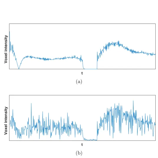 Figura 3.5: Illustrazione della signature temporale di un singolo voxel acqui- acqui-sita con un approccio di MRF basato sulla sequenza IR-bSSFP: totalmente campionata (a), con rumore e sottocampionamento del 15% (b).