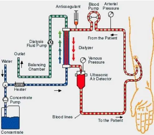 Fig. 1.3: Schema di un tipico circuito per la dialisi renale extracorporea