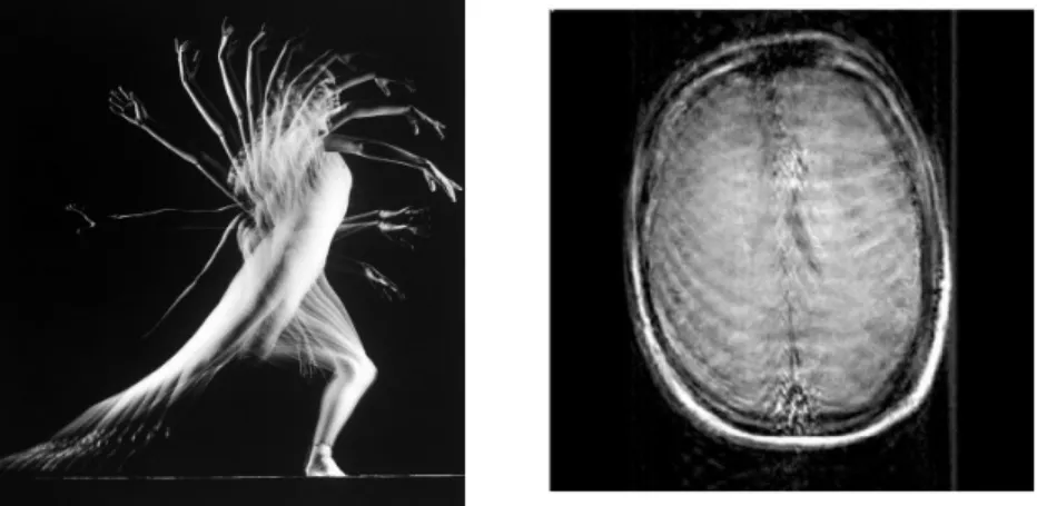 Figure 1.3: Motion. The difference between movement in real world and the effect of the movement in MRI [Zaitsev et al, Neuroimage, 2006].