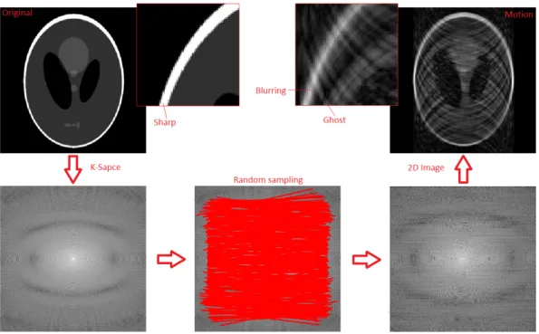 Figure 1.4: Blurring and Ghosting. These pictures shows simulations of motion effect [Code written by: Smith James, SPMIC, University of Nottingham, 2016]