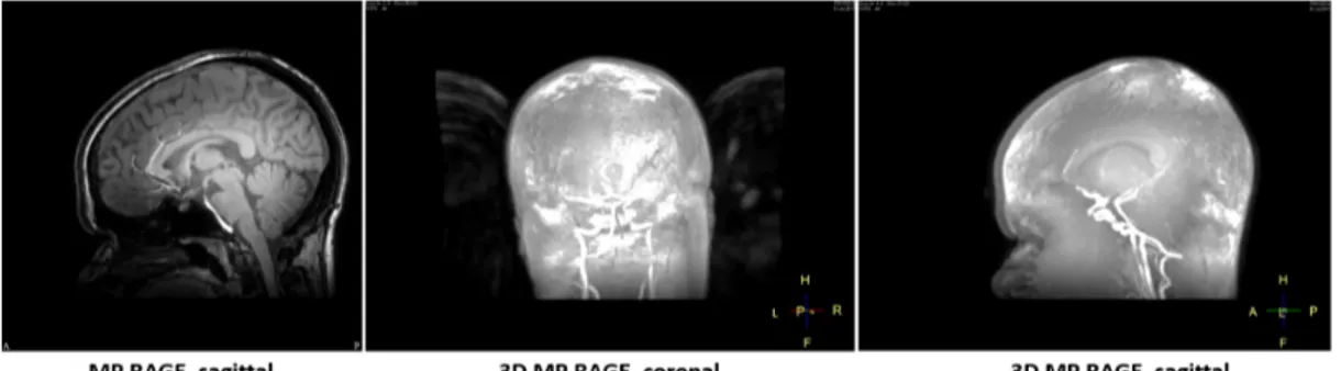 Figure 1.5: Example of ghost motion artefact. These pictures show clearly the ghost problem during MRI scans