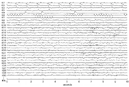 Figure 21 Sample segments of the  30  ICs  separated  with  FastICA  using  the  traces  presented  in  fig