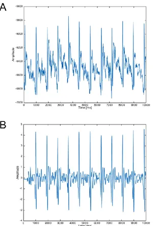 Figure 26 Initial 10 s of ECG signal recorded on subject 1 A) before and B) after the pre-processing steps