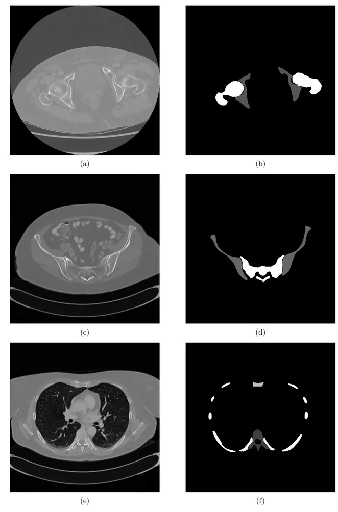 Figure 6.1: Three 2D images used for training. On the left side ((a),(c),(e)) the original images and on the right side ((b),(d),(f)) the respective bone masks.