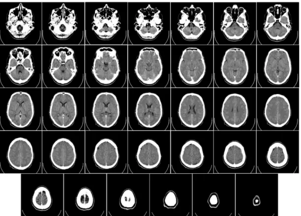 Figura 2.16: TAC di un cervello umano, dalla base del cranio fino in cima. Eseguita con mezzo di contrasto intravenoso.