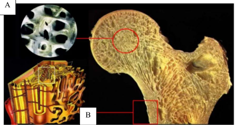 Fig. 1.2: Trabecular (A) and Cortical (B) Bone in proximal femur 