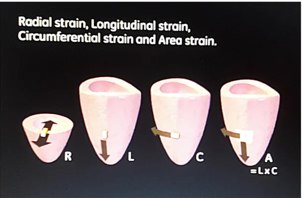 Figura 13: Rappresentazione degli strain durante la fase di sistole