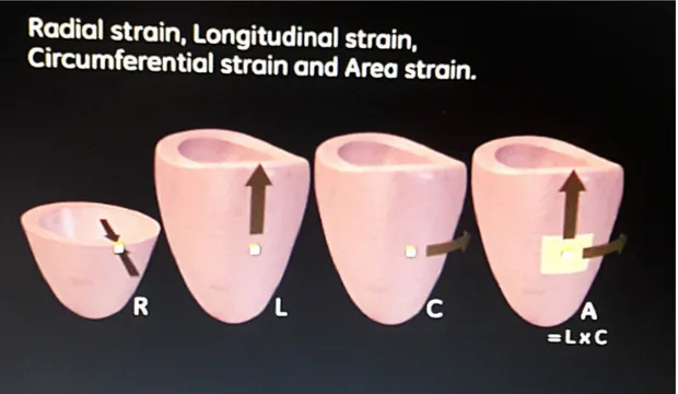 Figura 14: Rappresentazione degli strain durante la fase di diastole