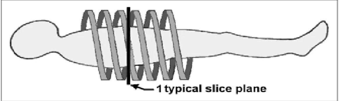Fig. 15 - Helical CT. Improved body CT was made possible with advent of helical  CT (or spiral CT)