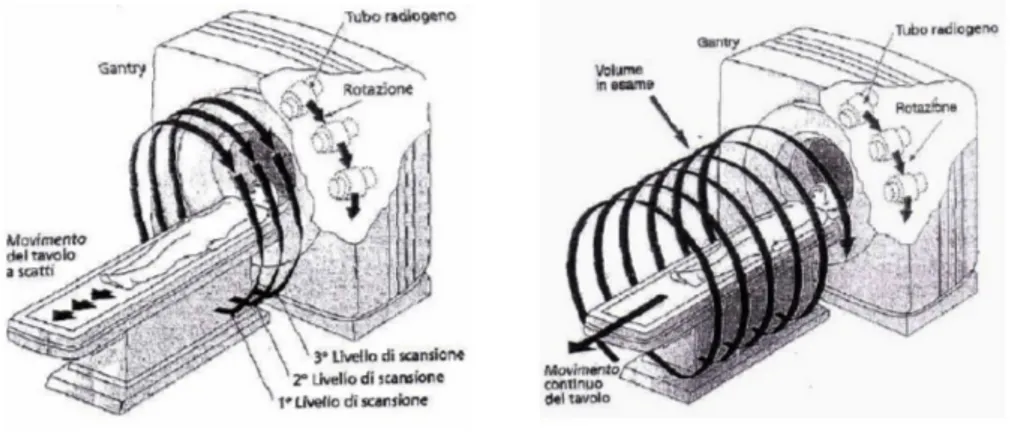 Figura 1.8: Modalità di acquisizione