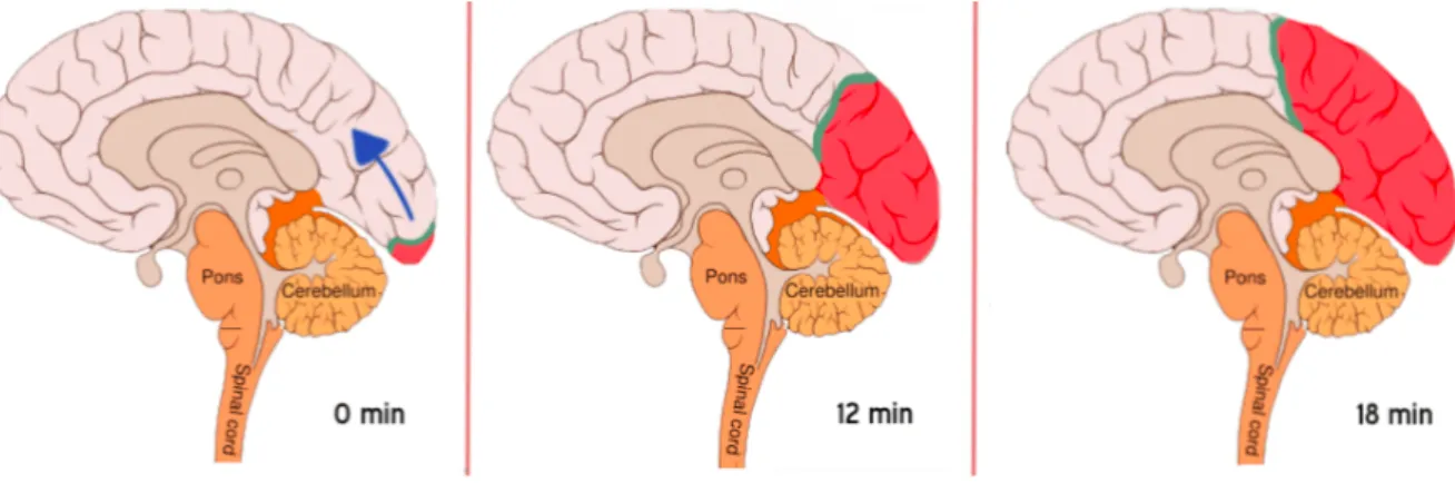 Figure 1.10: Evolution of the CSD. The green area represents the wave front (excitatory), the red one the cortical depression