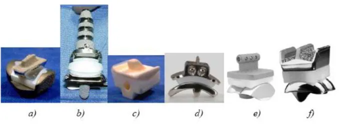 Fig  4.1    Protesi  di  caviglia  a  due  componenti,  attualmente  in  uso  per  la  TAR:  a)  Agility;  b)  Inbone;  c)TNK; d)Eclipse; e)ESKA; f) Salto Talaris