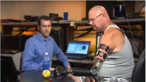 Figura 1.5: I dispositivi Myo qui illustrati sono dispositivi in grado di captare i segnali elettrici che percorrono il sistema nervoso e muscolare del braccio