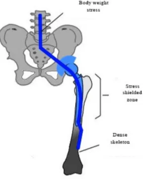 Figure 1.8 : Load direction of body weight 