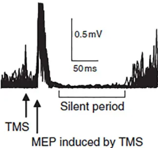 Figura 7: periodo silente registrato tramite EEG 