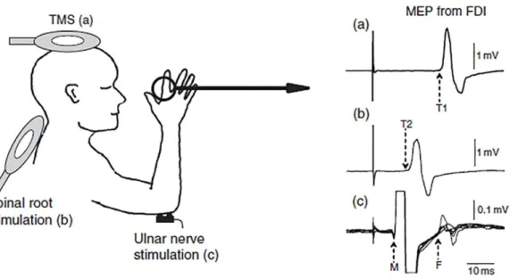 Figura 8:rappresentazione schematica del calcolo del CMCT. a) MT indotto dalla TMS. b) MEP  dopo la stimolazione della radice spinale cervicale