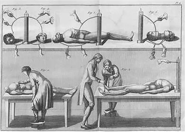 Figura 10: illustrazione degli esperimenti di Giovanni Aldini sui cadaveri 