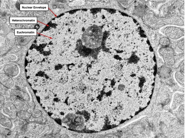 Figura 1.10: Nucleo cellulare. Si distinguono l'eterocromatina, in forma di piccole particelle scure, e l'eucromatina, meno addensata e localizzata.