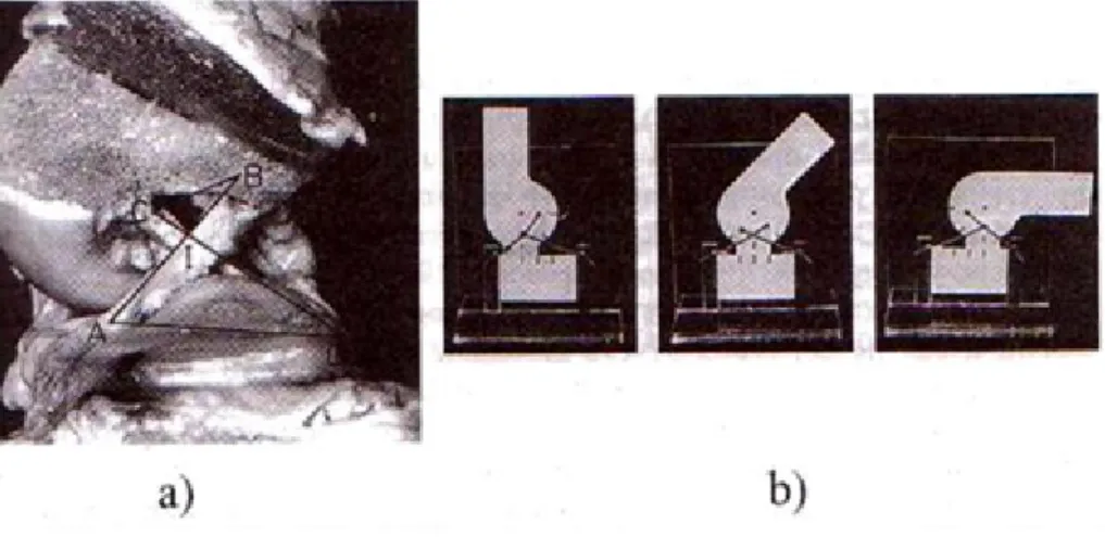 Figura 1.14: Meccanismo planare del ginocchio: a) Immagine laterale presa da una sezione del ginocchio sx con i condili rimossi, che espongono i due  legamen-ti crocialegamen-ti; a questo ` e stata sovrapposta la rappresentazione del meccanismo a 4 barre A