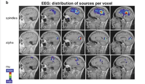 Figura 1.5: dai dati dell’EEG rappresentati in figura si pu` o notare che non vi