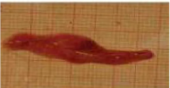 Figura 15: Ovario di acciuga in  fase di &#34;deposizione 