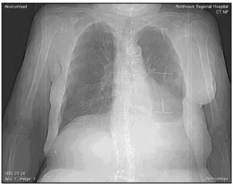 Figura 1.5: Immagine DICOM