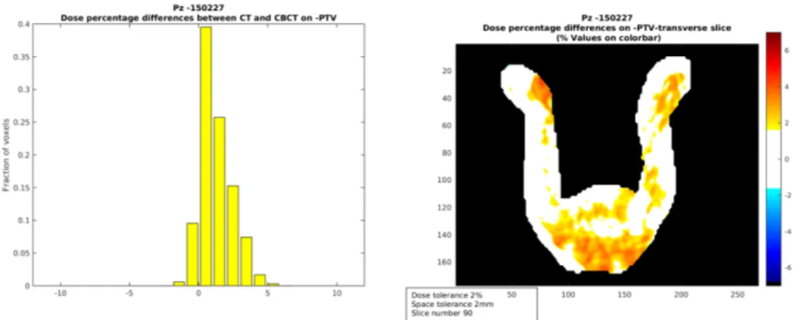 Figura 3.14: Istogramma degli scarti percentuale di dose sulla struttura PTV (sinistra) e visualizzazione degli stessi sulla slice selezionata in corrispondenza dell’isocentro (destra)