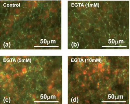 Figure 1.1: Images showing the immunofluorescent staining of the tight junction protein ZO-1 in the epithelial cell monolayers, treated with EGTA at the concentrations indicated