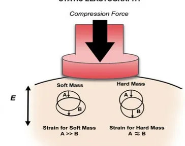 Figura 9.  Strain elastography: applicazione della forza di compressione che deforma il  tessuto in esame