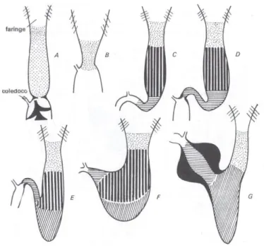 Figura 12 Diagrammi mostranti le diverse parti dell'intestino anteriore in Protopterus (A), Cyprinus (B), Esox  (C)Leuciscus (D), Anguilla (E), Cottus (F), Mugil (G) (Vannini, 1982) 