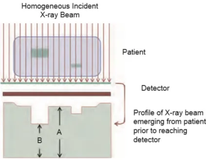 Figura 2.1: Attenuazione del fascio di raggi X che genera un profilo eterogeneo del fascio emergente dal paziente che andr` a in seguito ad incidere sui rivelatori.
