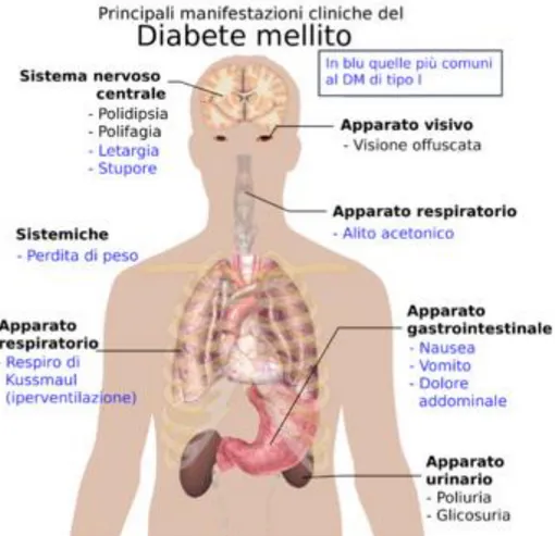 Figura 1.1 Principali manifestazioni cliniche del Diabete Mellito 