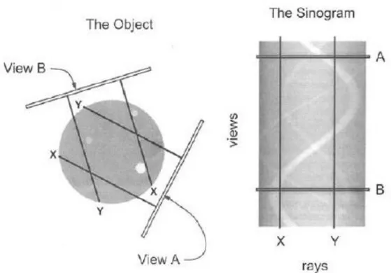 Figura 2.39: Esempio di sinogramma 