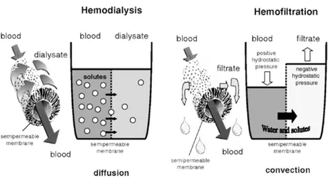 Figure 1.5: Difference between hemodialysis and hemofiltration [59]