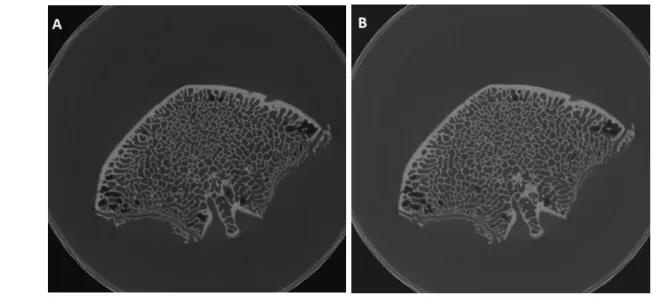 Fig. 2.9 - Esempio di doppia scansione di una vertebra naturale, senza alcun  riposizionamento