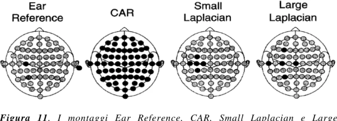 Figura  11.  I  montaggi  Ear  Reference,  CAR,  Small  Laplacian  e  Large  Laplacian