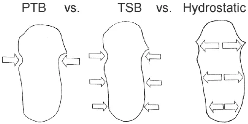 Figura 1.1 Confronto tra diversi tipi di invasature 