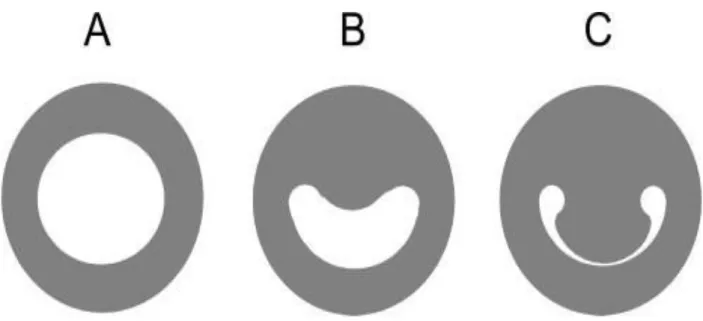 Figura 6. Forma della pupilla di un Tursiope a diversi livelli di illuminazione  A) Bassa illuminazione → pupilla a forma di ovale non ristretto 