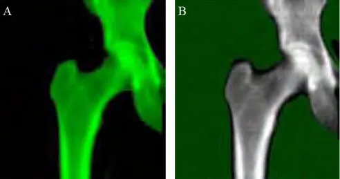 Figure 2.13: A femur projection by Lunar iDXA ME scanner: (A) results automatic bone point and (B) soft tissue point typing
