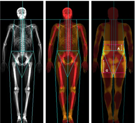 Figure 2.22: DXA examination of body composition (yellow for high fat percentage tissue, red for low fat percentage e lean tissue)