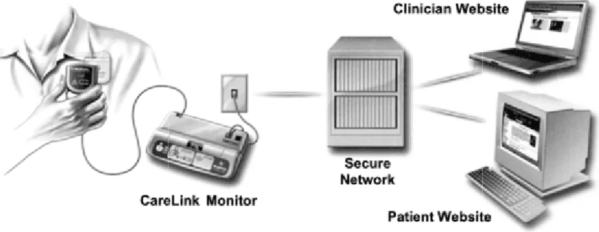 Fig. 2- Schematizzazione  trasferimento dati nel RMS.