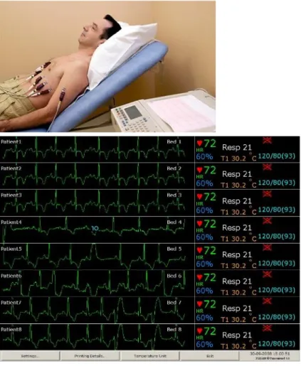 Figg 3.4,5 un elettrocardiografo in funzione e la visualizzazione a monitor  del segnale ECG in terapia intensiva 