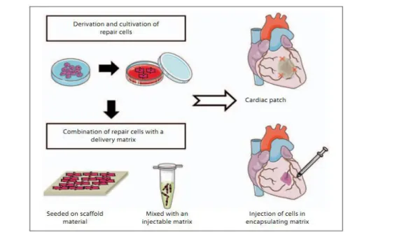 Figura  3.1  :  In  alto  schema  di  cellule  seminate  su  scaffold;  in  basso  cellule  iniettate  in  matrice 