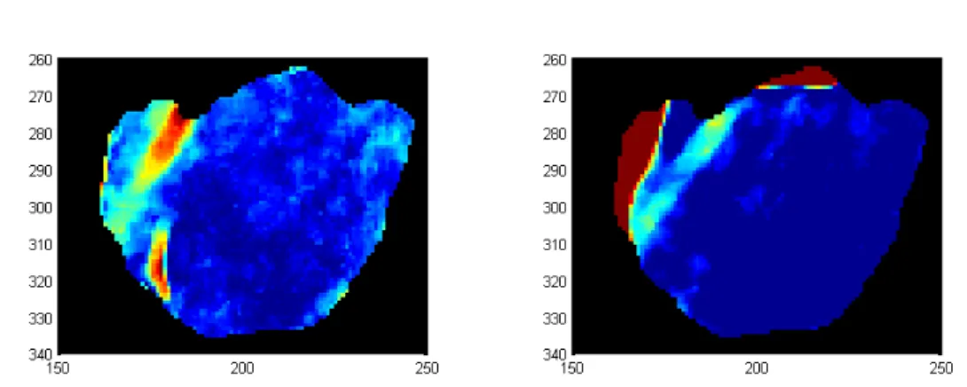 Figura 4.24: Esito della riduzione monodimensionale della funzione distanza, a sinistra con allineamento Best, a destra Manual e riduzione con criterio di Sammon