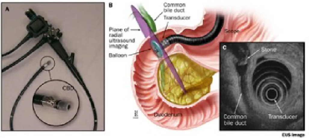 Figura 1.9: A. eco-endoscopio; B. eco-endoscopio nel tratto digestivo superiore;                     C