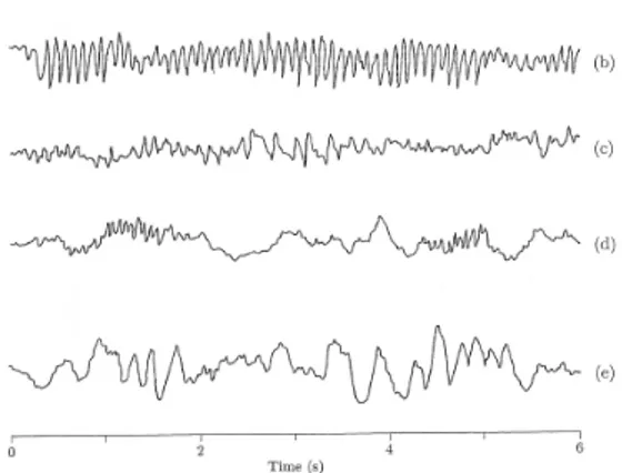 Figura 1.2: Ritmi EEG osservati durante vari stati di coscienza: (a) eccitazione, (b) relax,  (c) sonnolenza, (d) sonno (e) sonno profondo [7] 