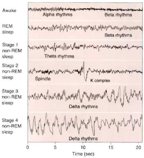 Figura 3.2: Tracciati EEG durante le diverse fasi del sonno