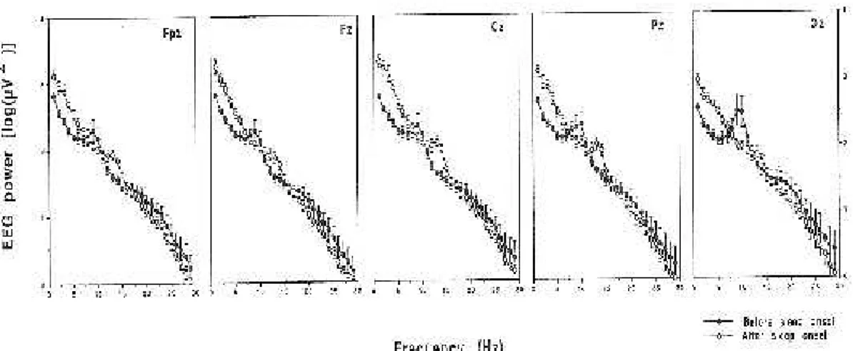 Figura  3.4: Potenza  EEG  (in  scala  logaritmica)  registrata  dalle  derivazioni frontopolare (Fpz), frontale (Fz), centrale (Cz), parietale (Pz) e occipitale (Oz).