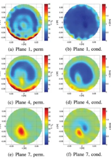 Figura 3.5: Risultati ottenuti attraverso l'algoritmo GN-T della mammella destra di una paziente